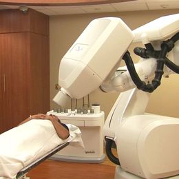 Radiation Improves Breast Cancer Survival Rates