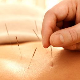 Acupuncture Pinpoints Real Pain Relief