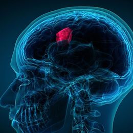 Study: Cell Phones Don't Raise Brain Tumor Risk