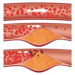 State-of-the-Heart Tests