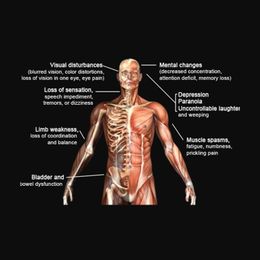 The Key to Reducing Multiple Sclerosis by 90%