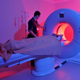 MRI Better for Diagnosing Strokes