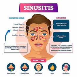 Sinusitis Could Start In the Stomach
