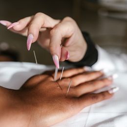 Acupuncture May Relieve Heartburn in Pregnancy