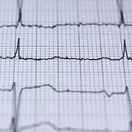 New Drug Helps Some Patients Avoid Heart Attack and Stroke