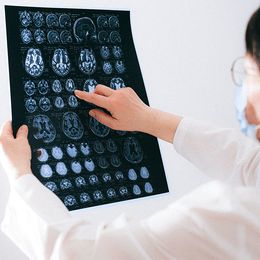 Brain Scans May Explain Memory Problems in Some MS Patients
