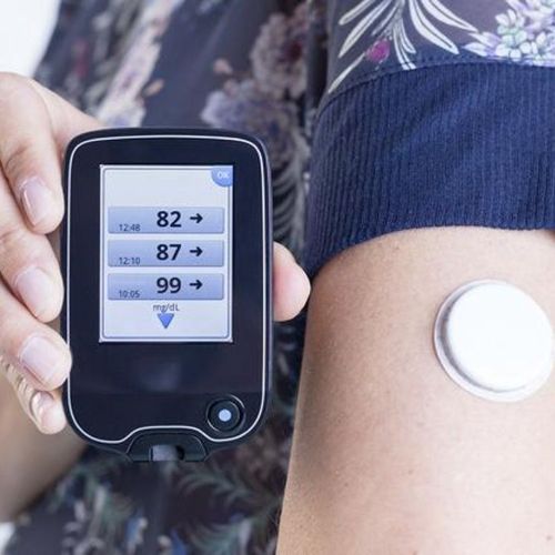 Glucose Monitor Updates