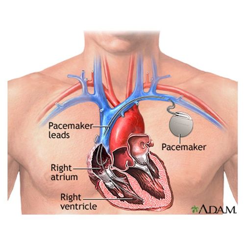 Embryonic Stem Cells May Replace Pacemakers
