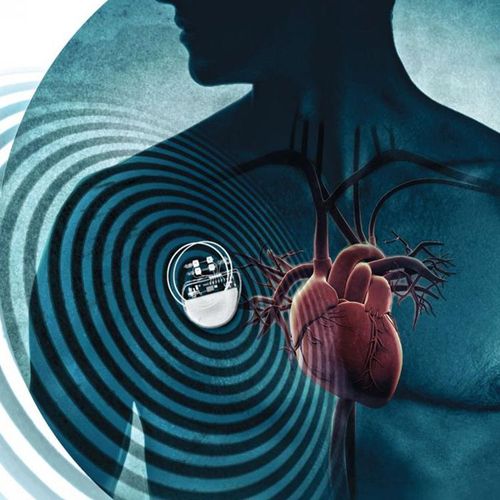 Pacemakers Seem Safe From 'WiFi' Devices