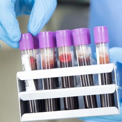 How to Tell What Your Lab Tests Really Mean