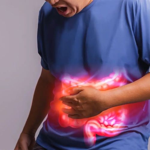 Identifying IBS