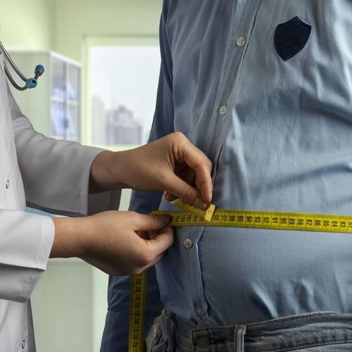What Is Bariatric Surgery?