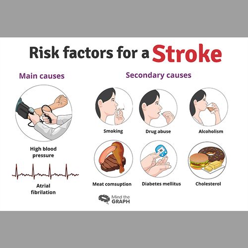 Best Ways to Cut Your Stroke Risk