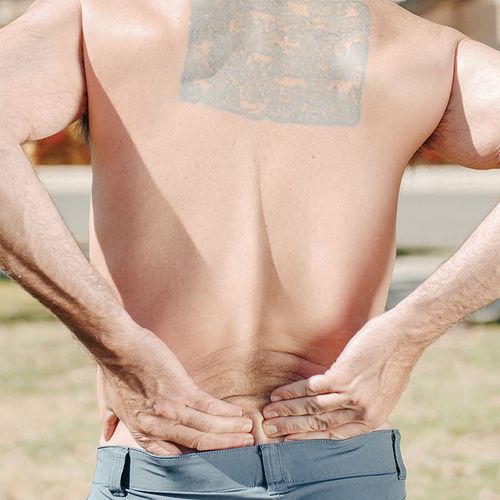 Disk Transplant May Mean Long-Term Relief From Back Pain