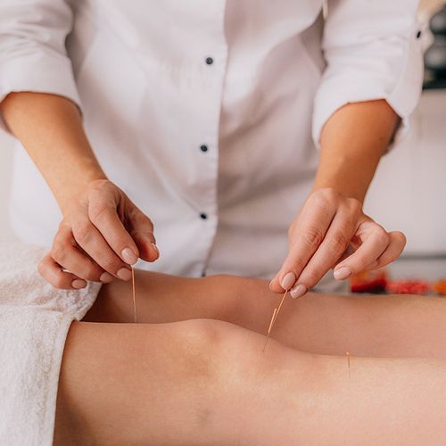 Acupuncture Zaps Surgical Pain