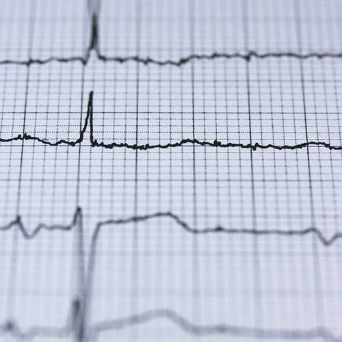 Lower Heart Attack and Stroke Risk by 60%