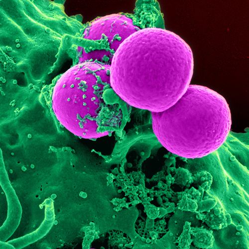 "Nightmare" Bacteria Spreading in US